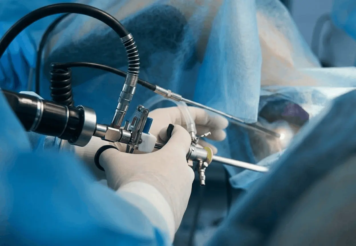 Role of hysteroscopy in infertility